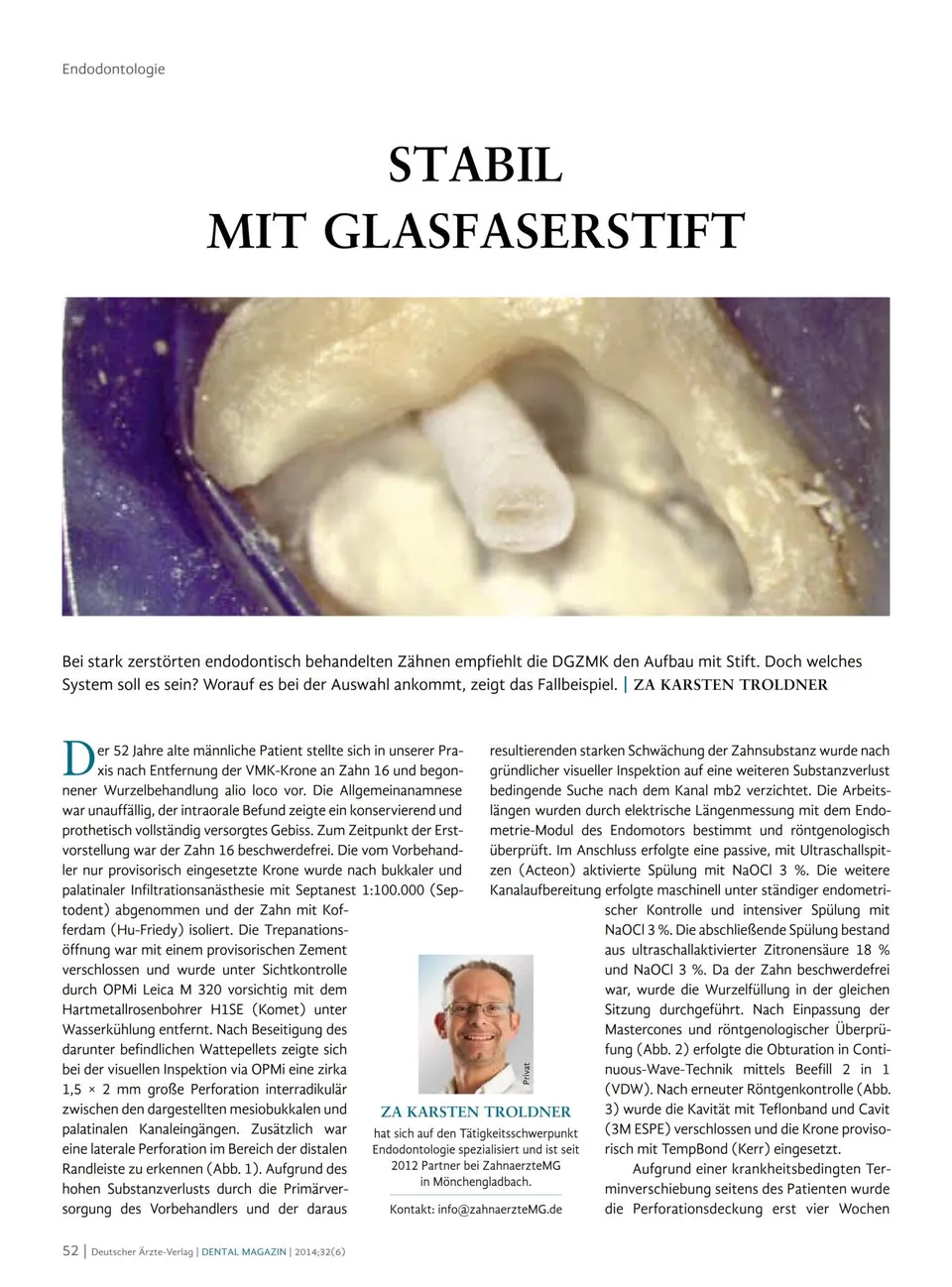 komet-cerapost-glasfaserstift-fachbericht-stiftaufbau image 1