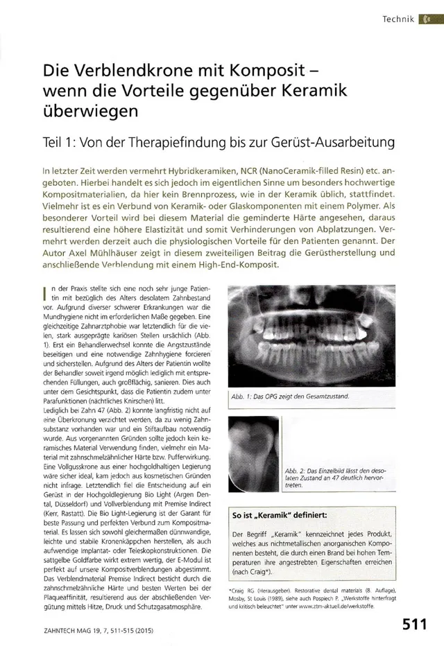komet-dental-ceracut-fachbericht-verblendkrone-komposit-teil-1 image 1