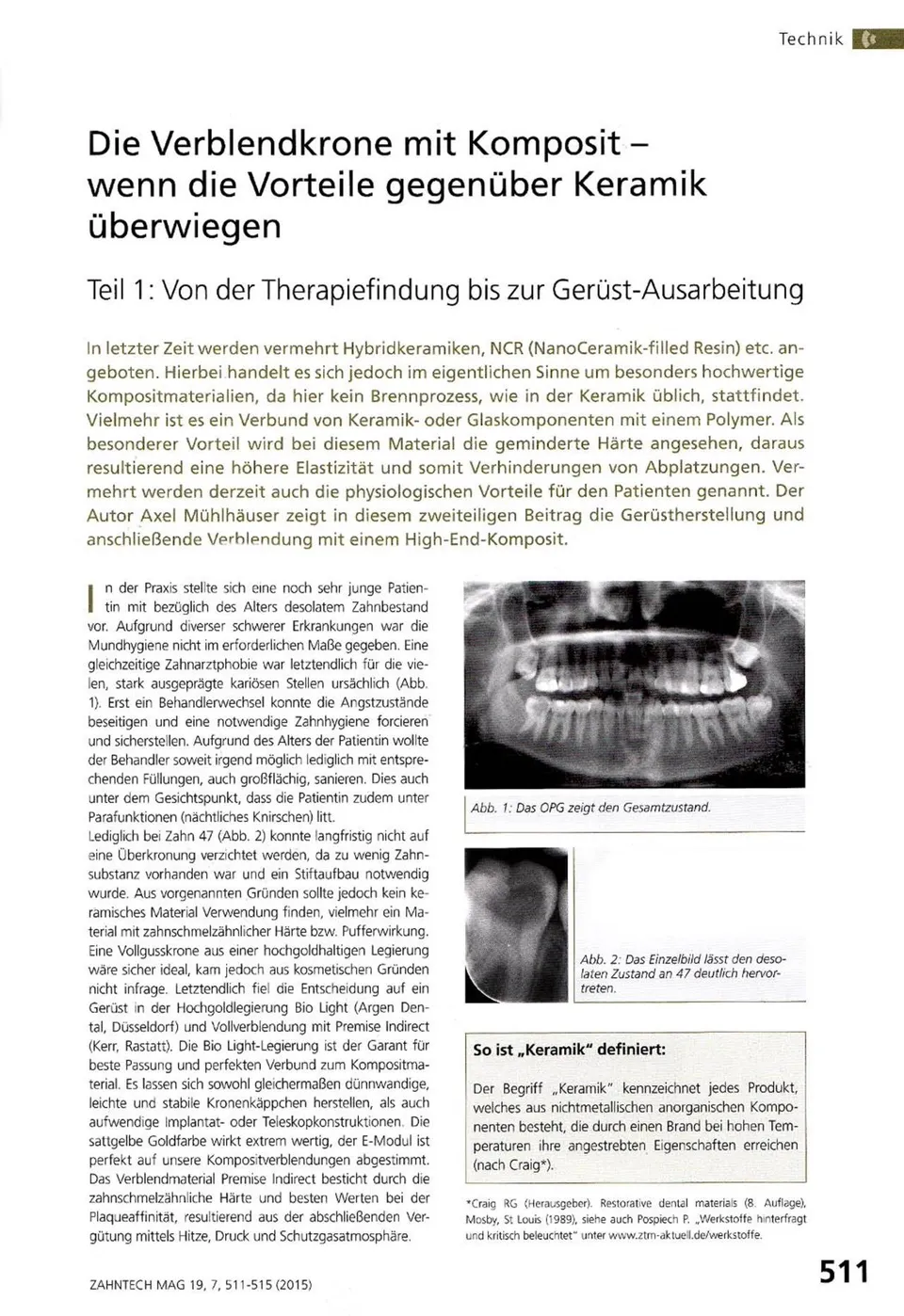 komet-dental-ceracut-fachbericht-verblendkrone-komposit-teil-1 image 1