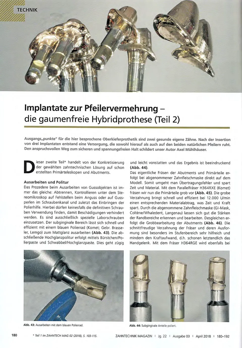 komet-dental-fq-fachbericht-hybridprothese-pfeilervermehrung image 1
