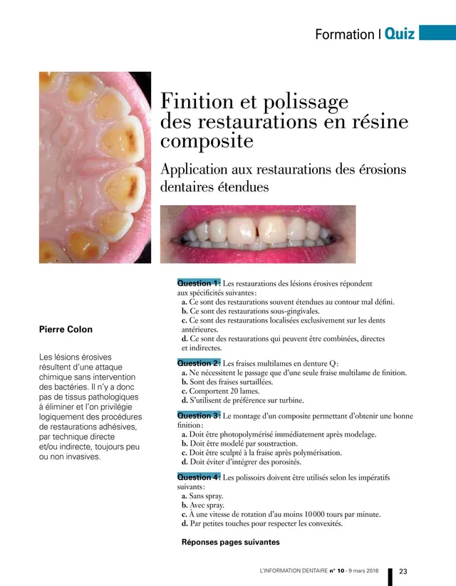 komet-fq-fachbericht-composite-finition-politur-dr-colon image 1