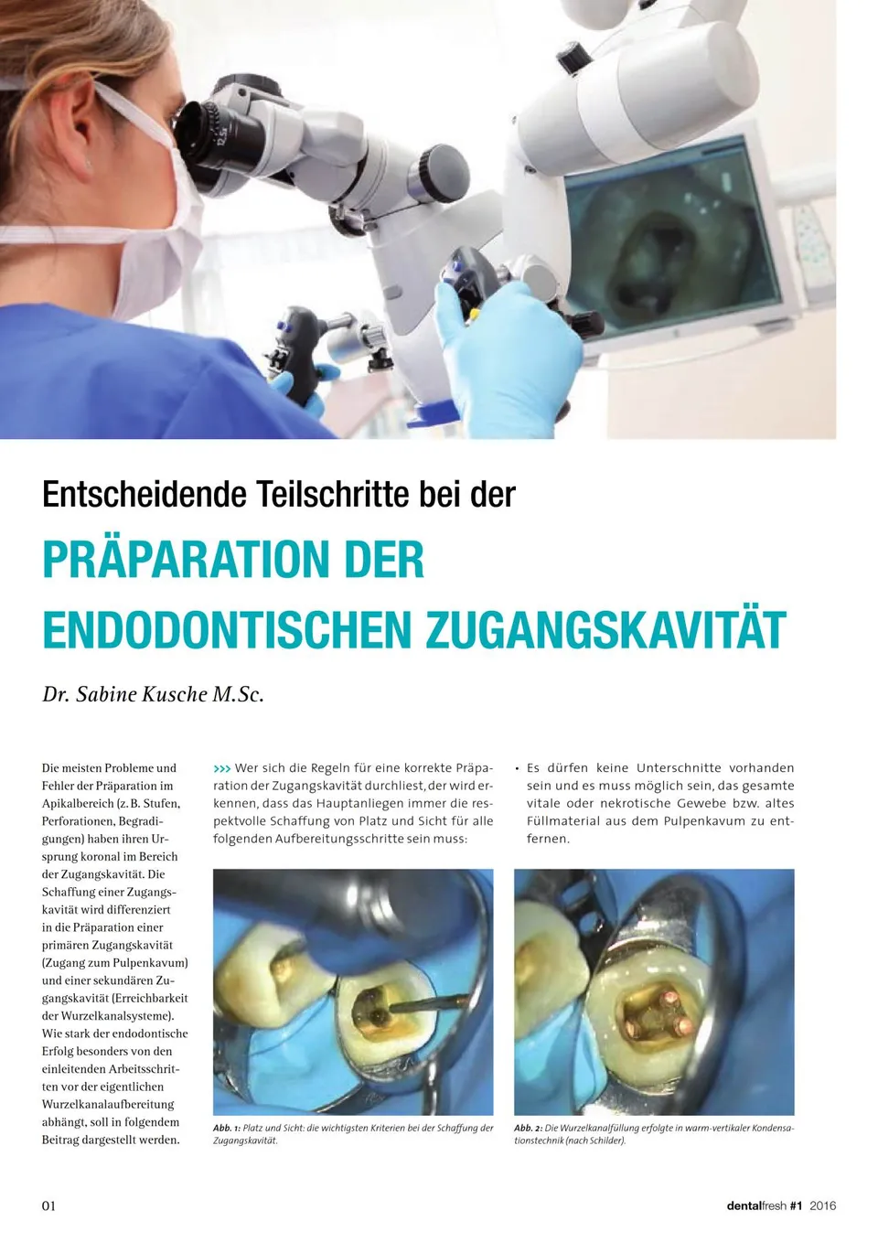 komet-dental-fq-fachbericht-zugangskavit-t-endodontie-02-2016 image 1