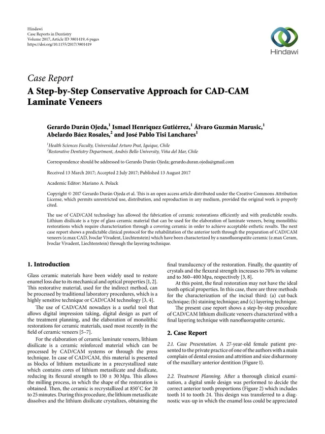 komet-diao-fachbericht-cad-cam-veneers-laminate-konservativ image 1