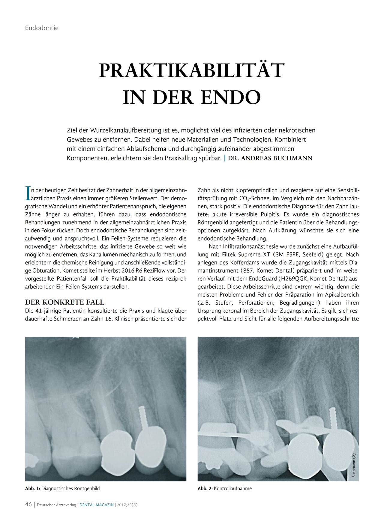 komet-dental-fq-fachbericht-endo-wurzelkanal-06-2017 image 1