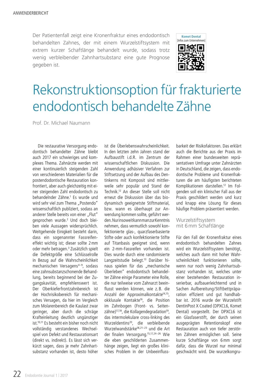 komet-dental-fq-fachbericht-frakturierte-z-hne-endo-02-2017 image 1
