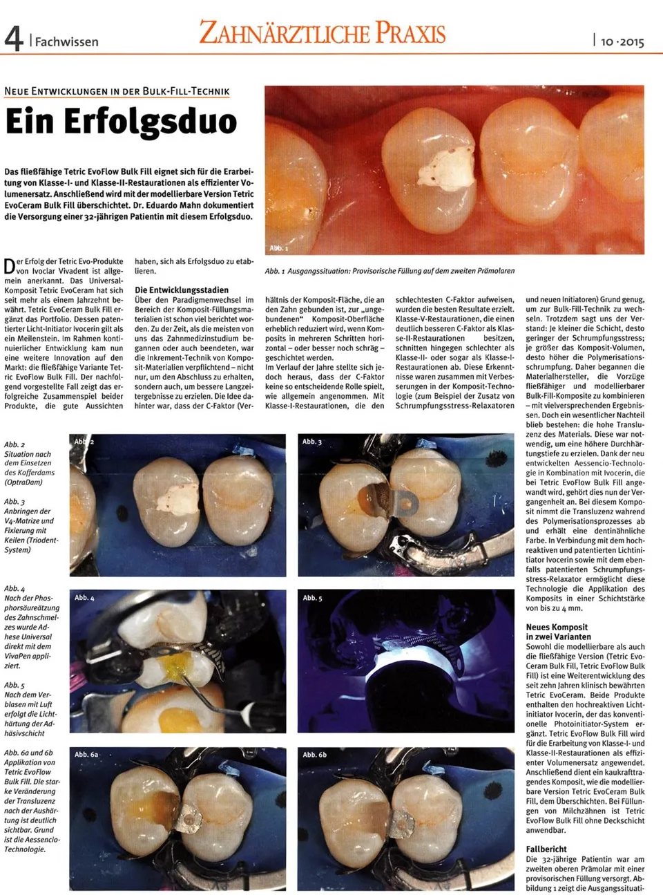 komet-dental-ceracut-fb-schallspitze-composite-f-llung image 1
