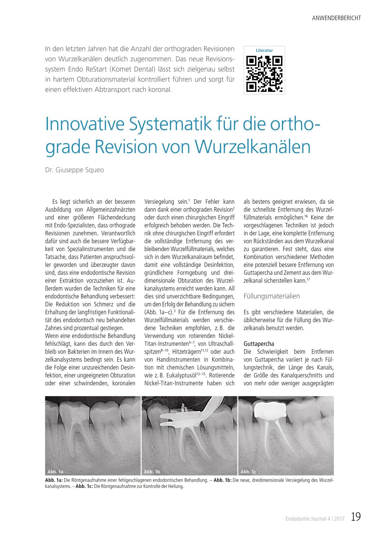 komet-dental-fq-fachbeitrag-orthograde-wurzelkanalrevision image 1