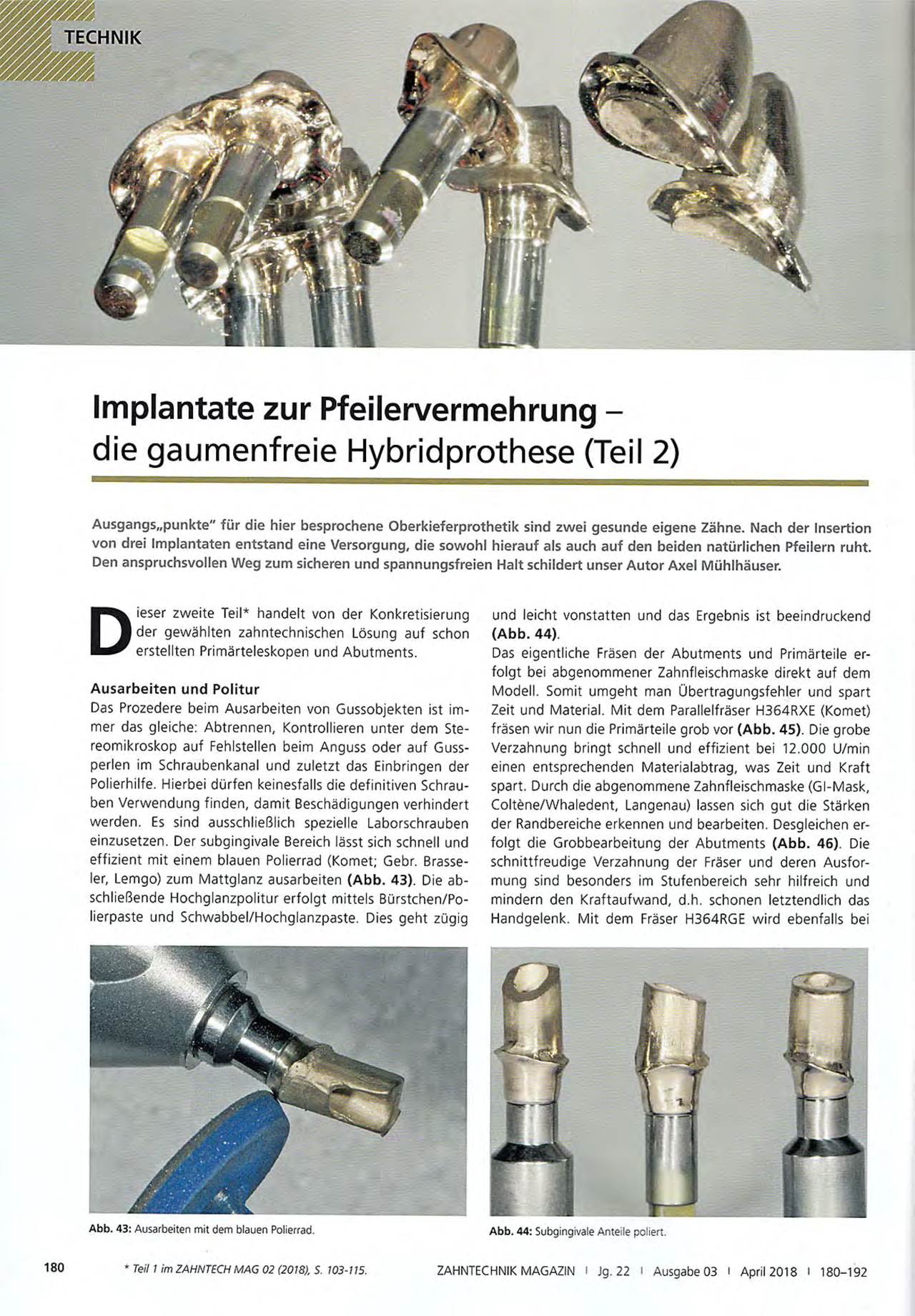 komet-dental-fq-fachbericht-hybridprothese-pfeilervermehrung image 1
