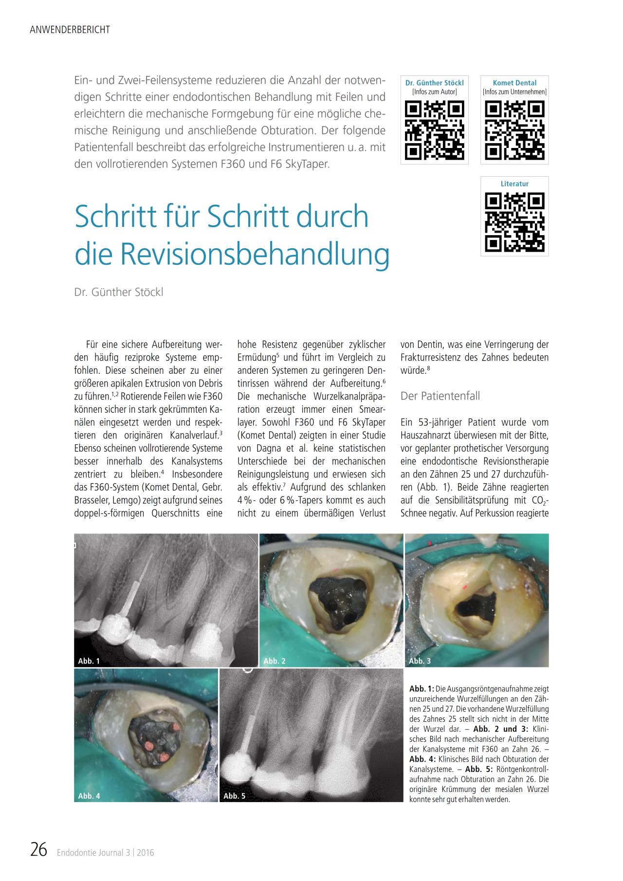 komet-dental-fq-f360-f6-skytaper-revision-fachbericht image 1