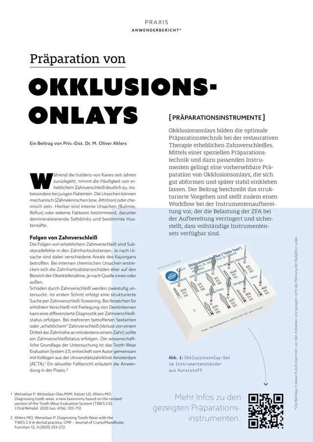 komet-dental-diao-fachbericht-2025-01-okklusionsonlays-pr-paration image 1