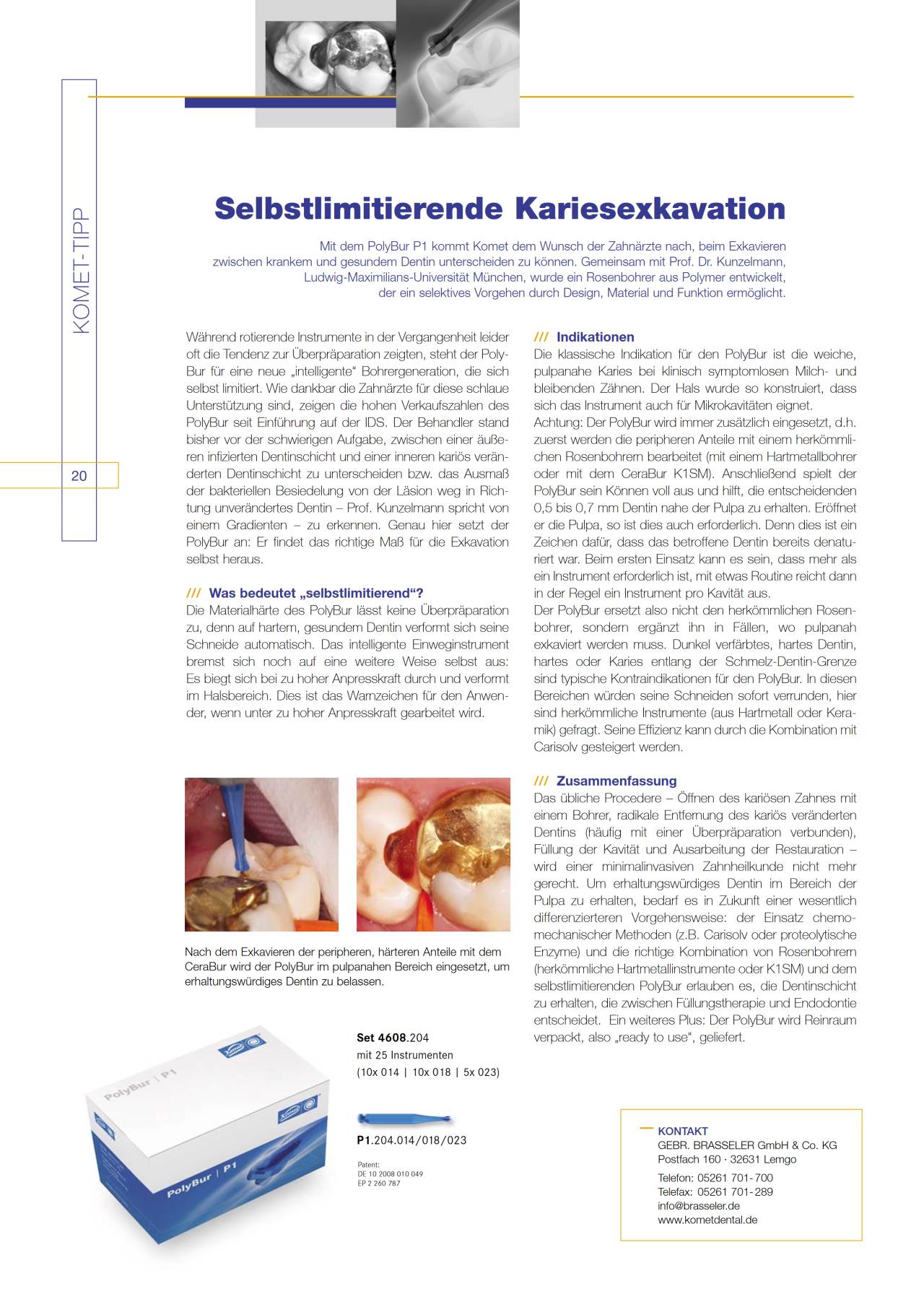 komet-dental-diao-2011-05-fachartikel-polybur-kariesexkavation image 1