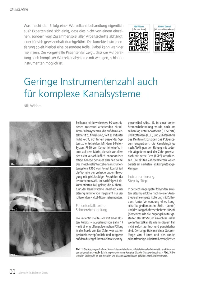 komet-dental-diao-kanalsysteme-fachbericht-endodontie-jahrbuch image 1