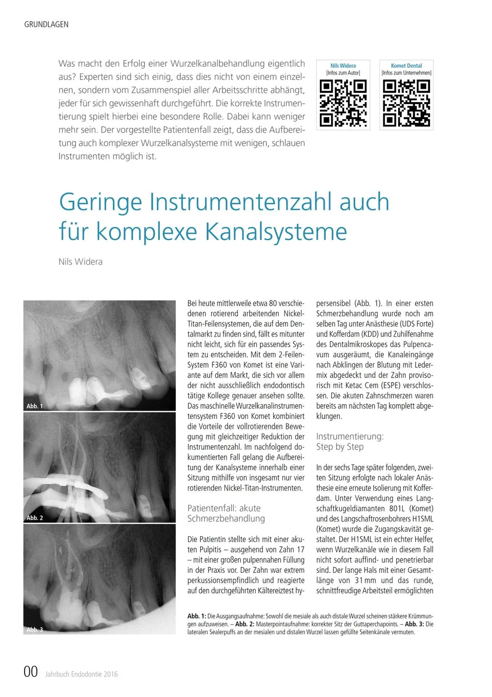 komet-dental-diao-kanalsysteme-fachbericht-endodontie-jahrbuch image 1