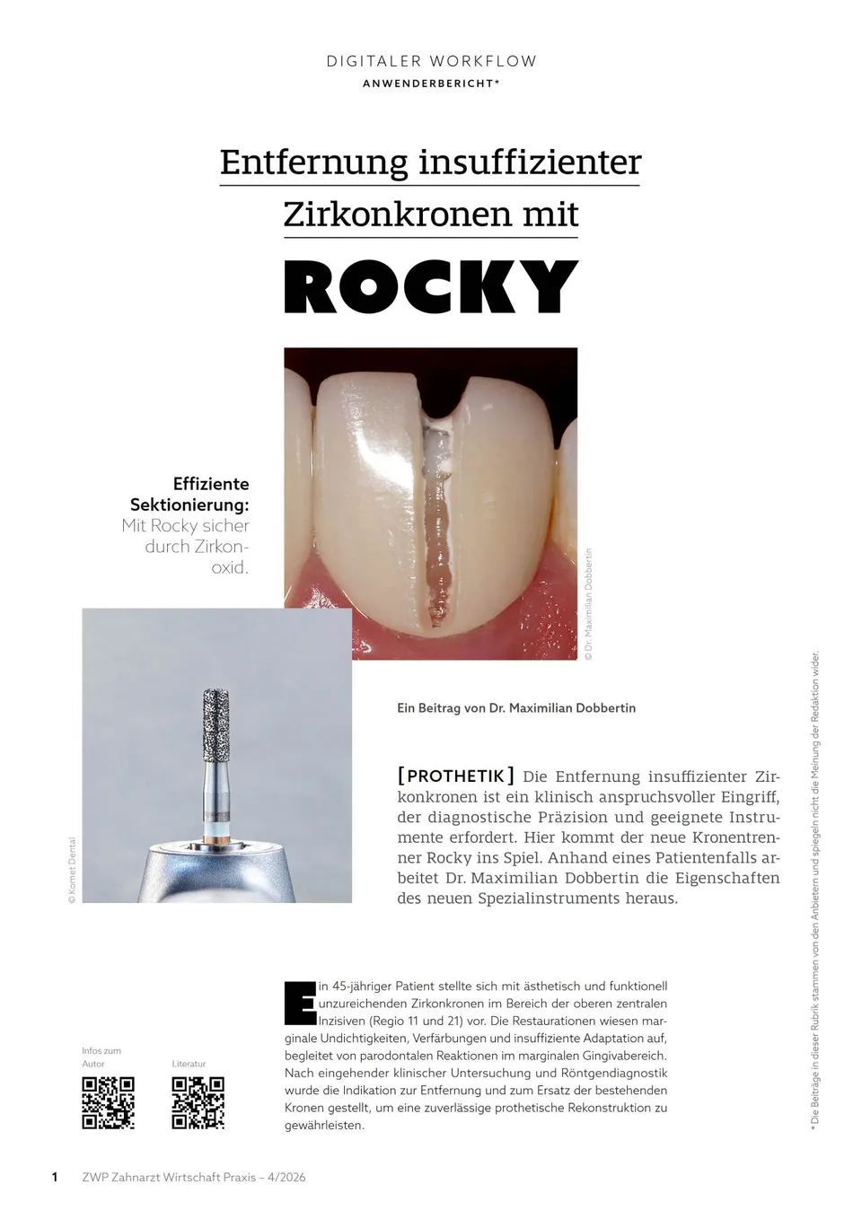 komet-rocky-fr-ser-zirkonkronen-entfernung-fachbericht image 1