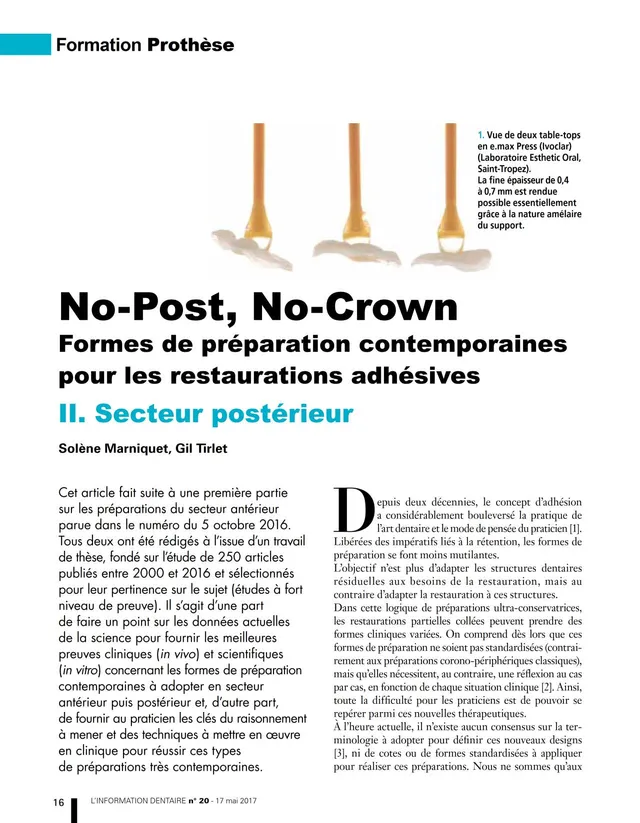 komet-dental-cerapost-fachbericht-no-post-no-crown-technik image 1