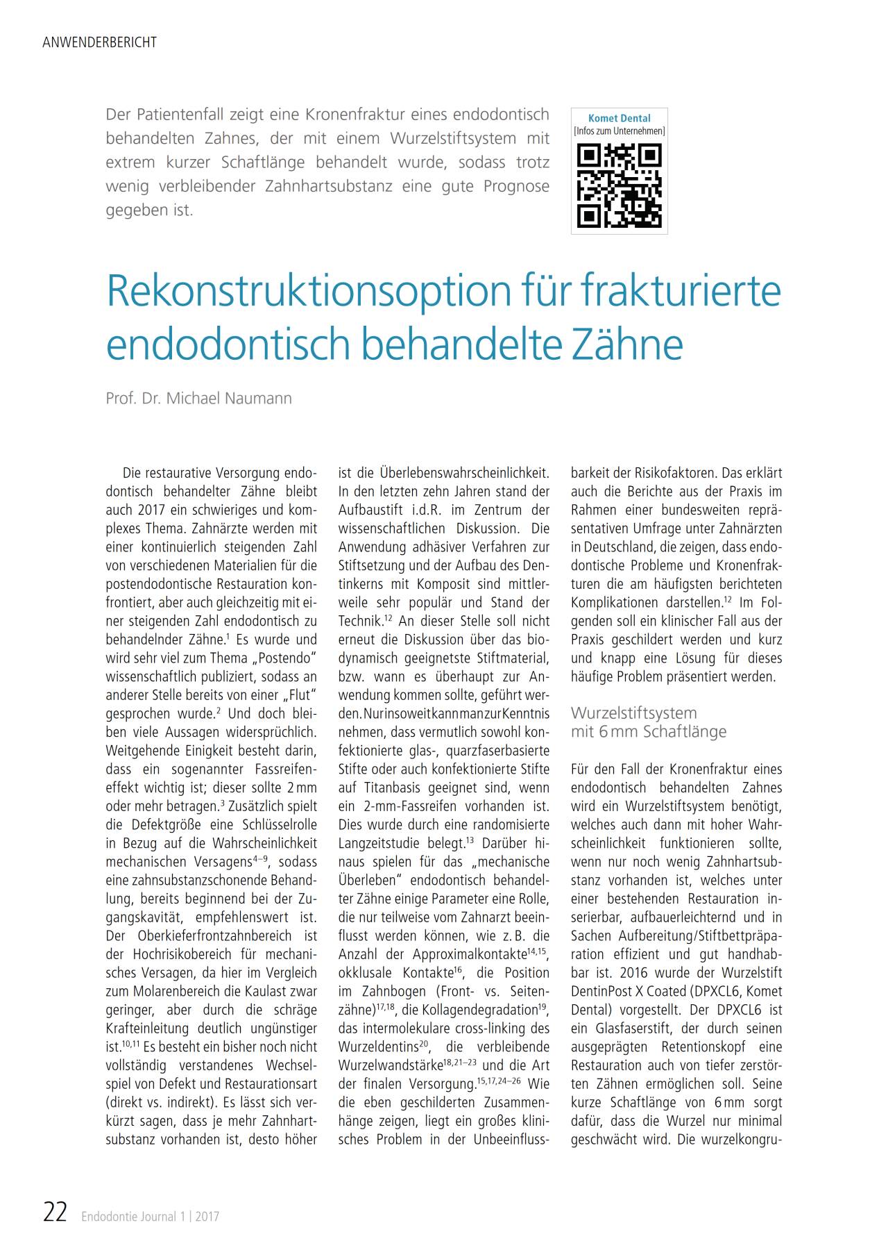 komet-dental-fq-fachbericht-frakturierte-z-hne-endo-02-2017 image 1