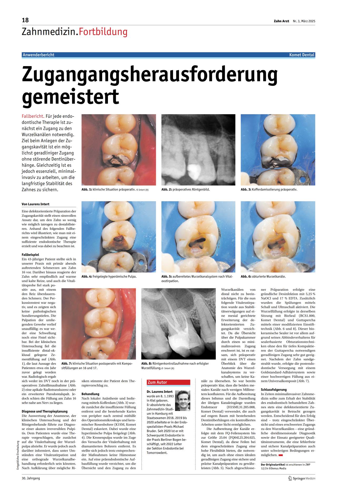 komet-dental-diao-fachbericht-zugangsherausforderung-m-rz-2025 image 1