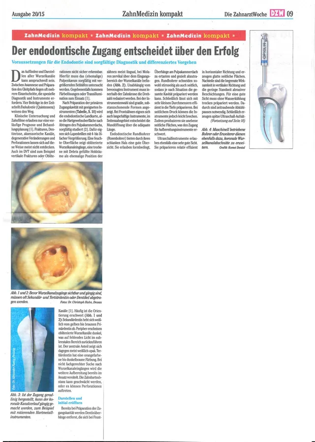 komet-dental-fq-fachbericht-endodontischer-zugang-pdf image 1
