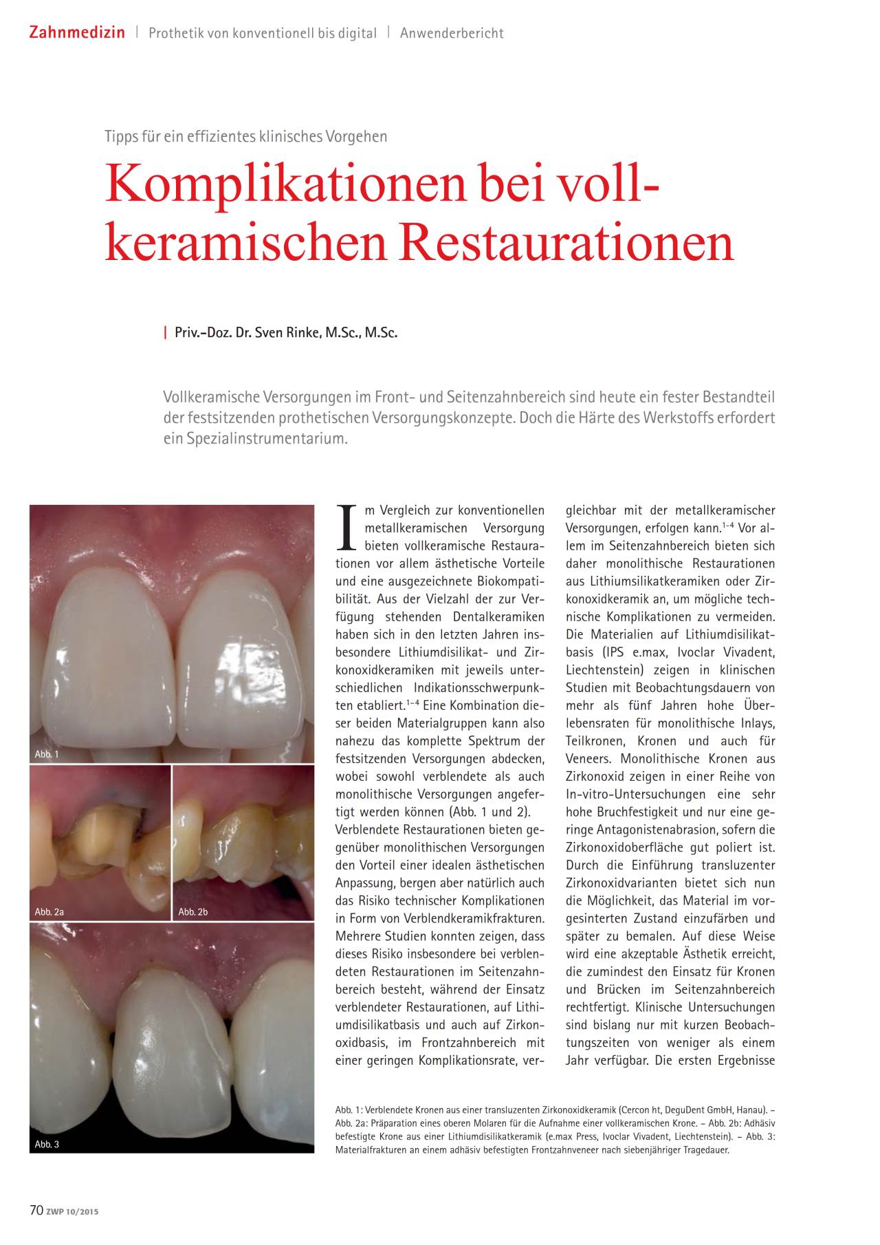 komet-dental-diao-vollkeramik-restaurationen-fachbericht-krone image 1