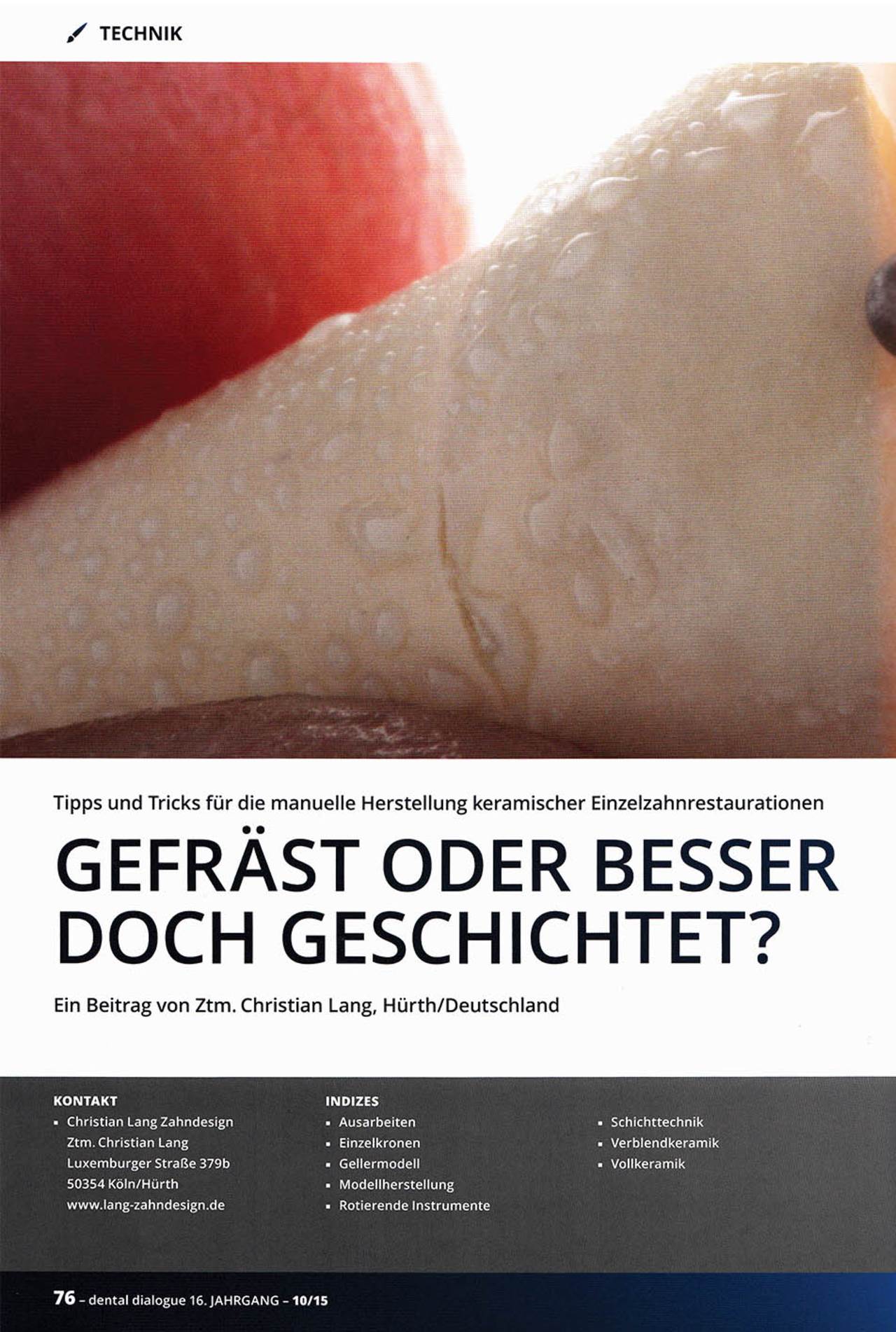 komet-diao-fachbericht-gefr-st-oder-geschichtet-keramik-einzelkrone image 1