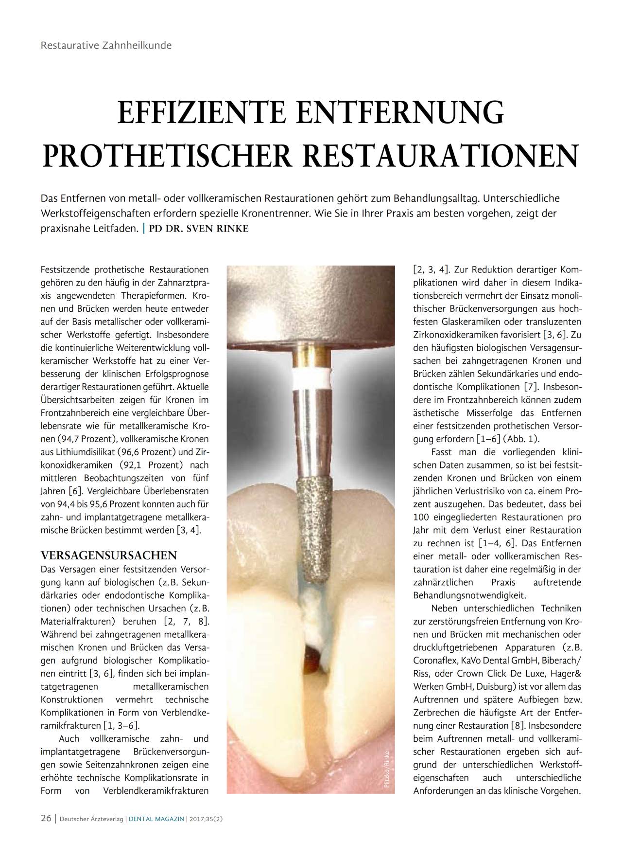 komet-dental-diao-fachbericht-kronentrenner-restauration image 1