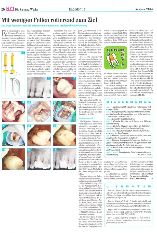 komet-fq-f360-fachbericht-zwei-feilensystem-rotierend-dzw image 1