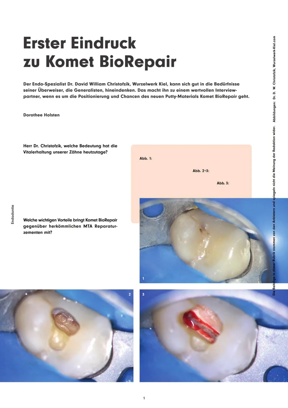 komet-dental-diao-fachbericht-biorepair-erster-eindruck image 1