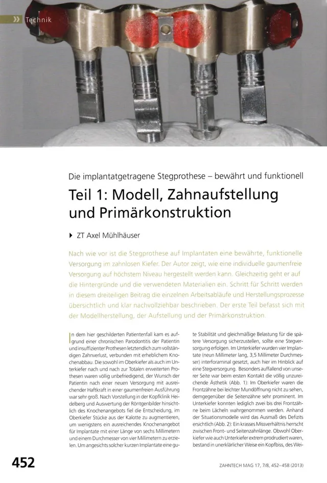 komet-dental-shax-fachbericht-stegprothese-modell image 1