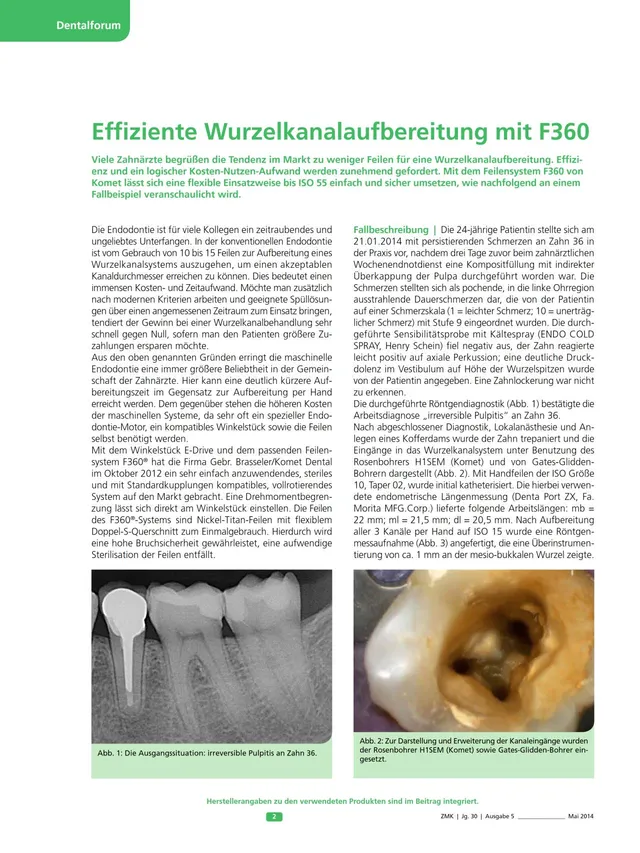 komet-f360-niti-feilen-wurzelkanal-iso-55 image 1