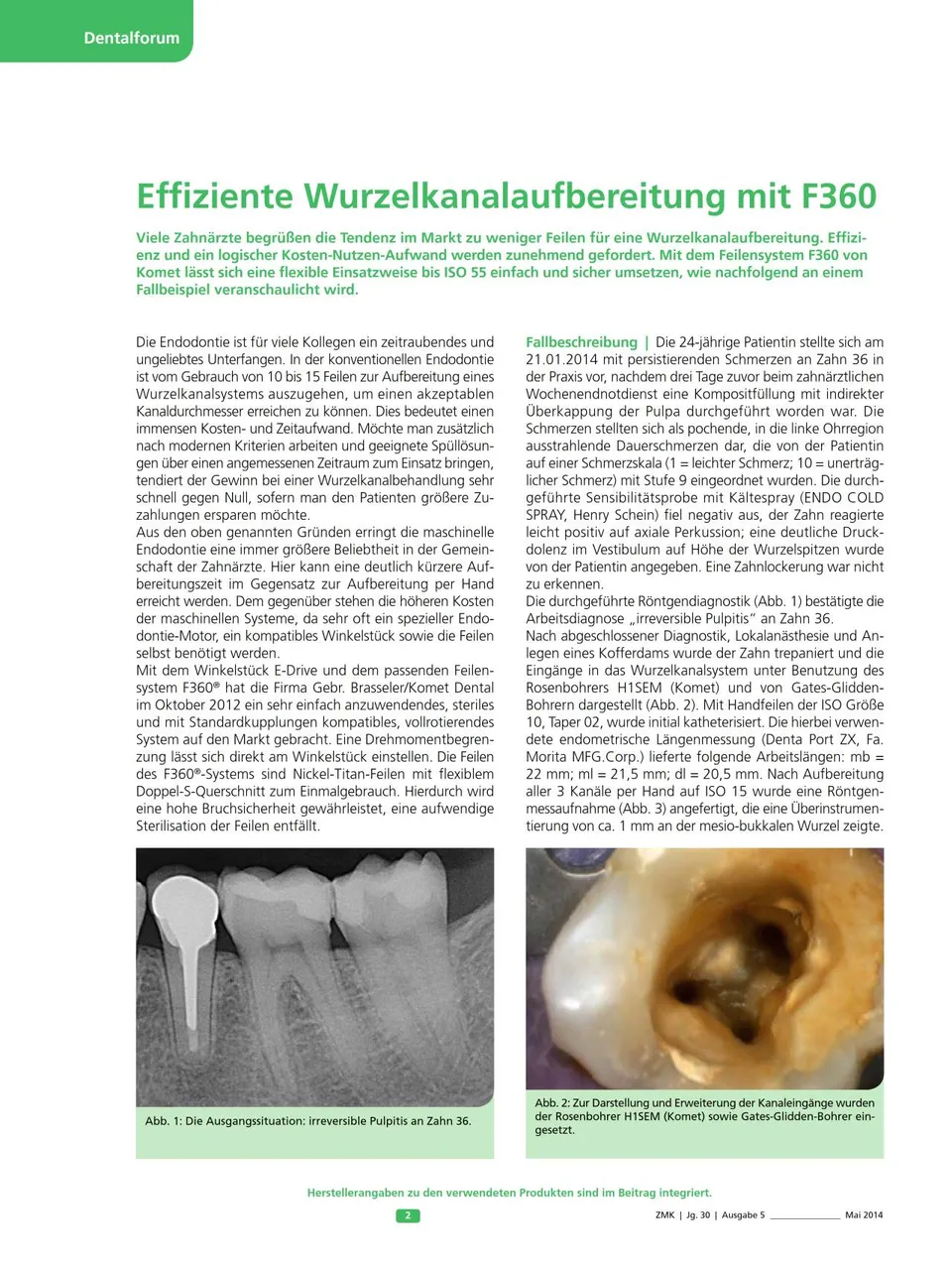 komet-f360-niti-feilen-wurzelkanal-iso-55 image 1