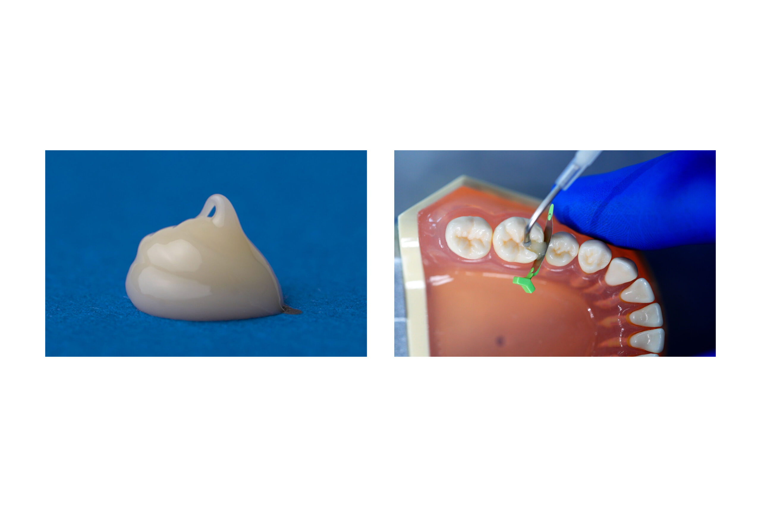 parkell-predicta-bioactive-bulk-komposit-dualh-rtend-bulkfill image 2