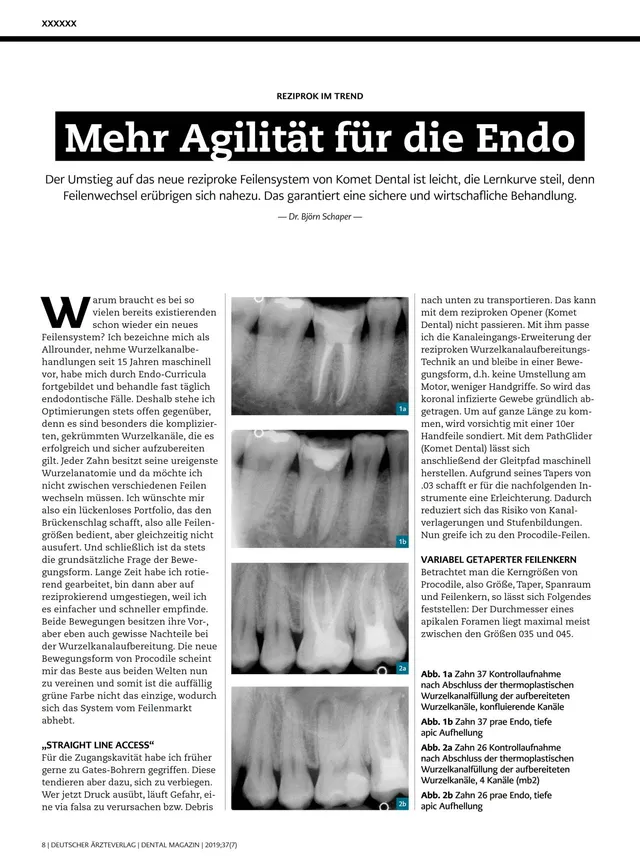 komet-dental-fq-procodile-fachbericht-endo-07-2019-schaper image 1