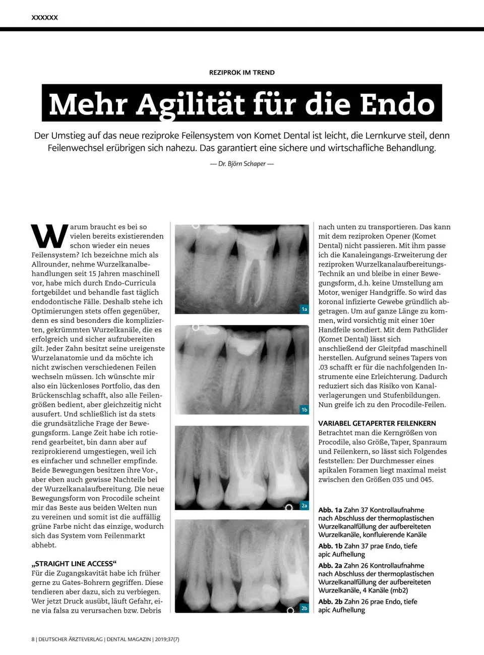 komet-dental-fq-procodile-fachbericht-endo-07-2019-schaper image 1