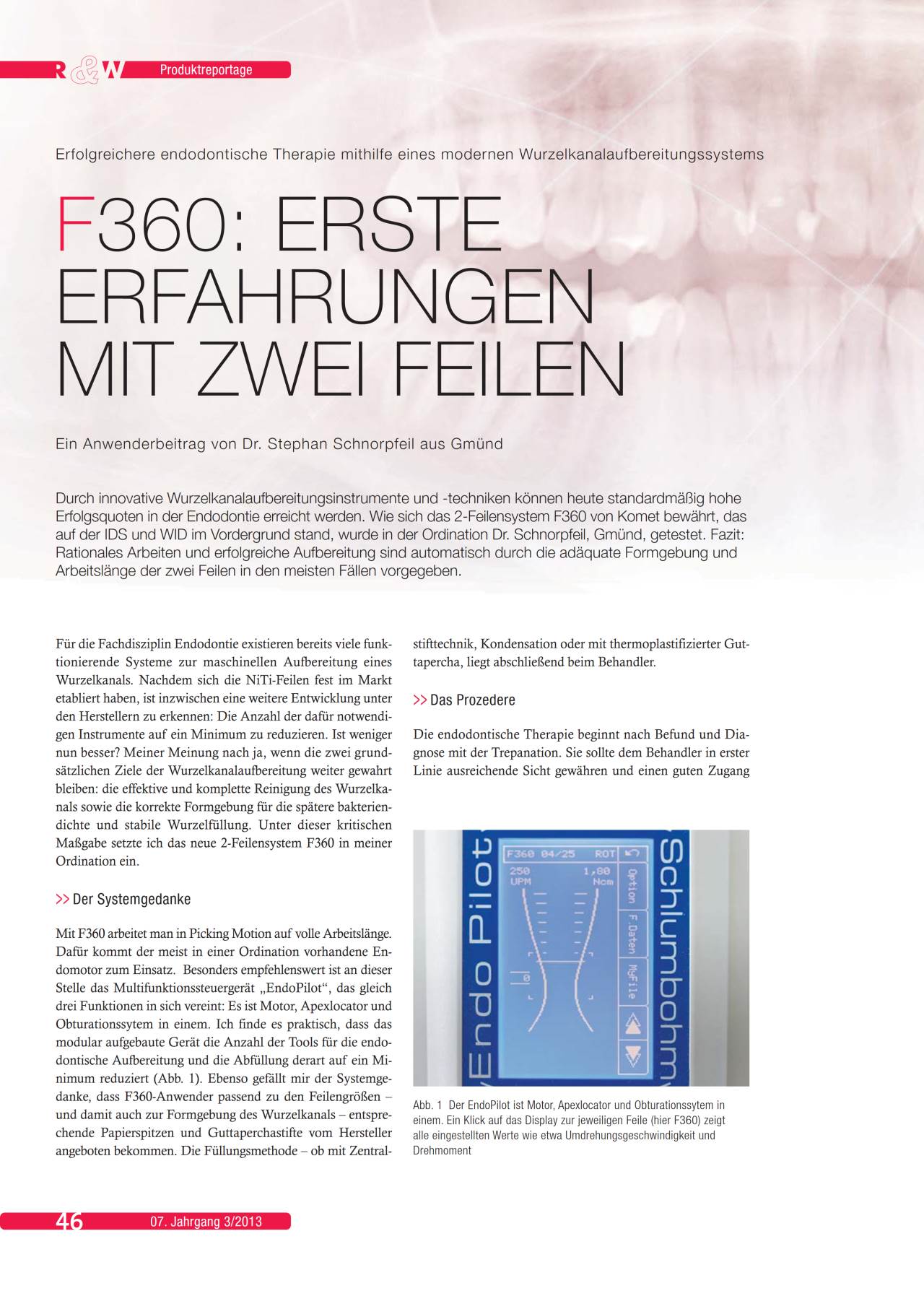 komet-f360-fachbericht-zwei-feilen-wurzelkanal-endo image 1