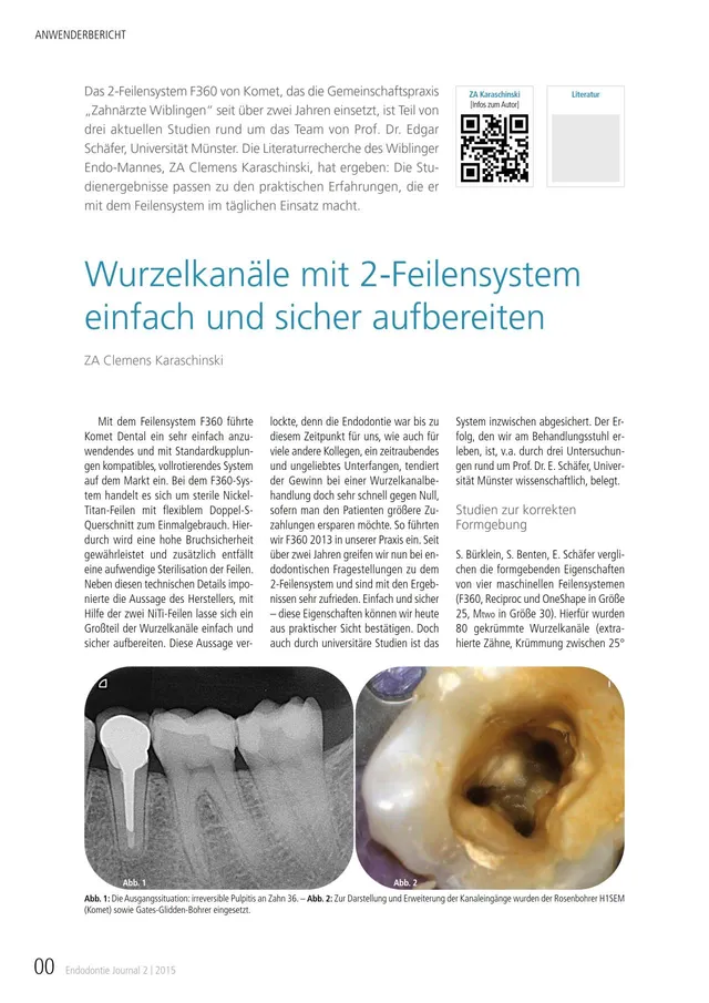 komet-dental-fq-f360-fachbeitrag-wurzelkanal-2-feilensystem image 1