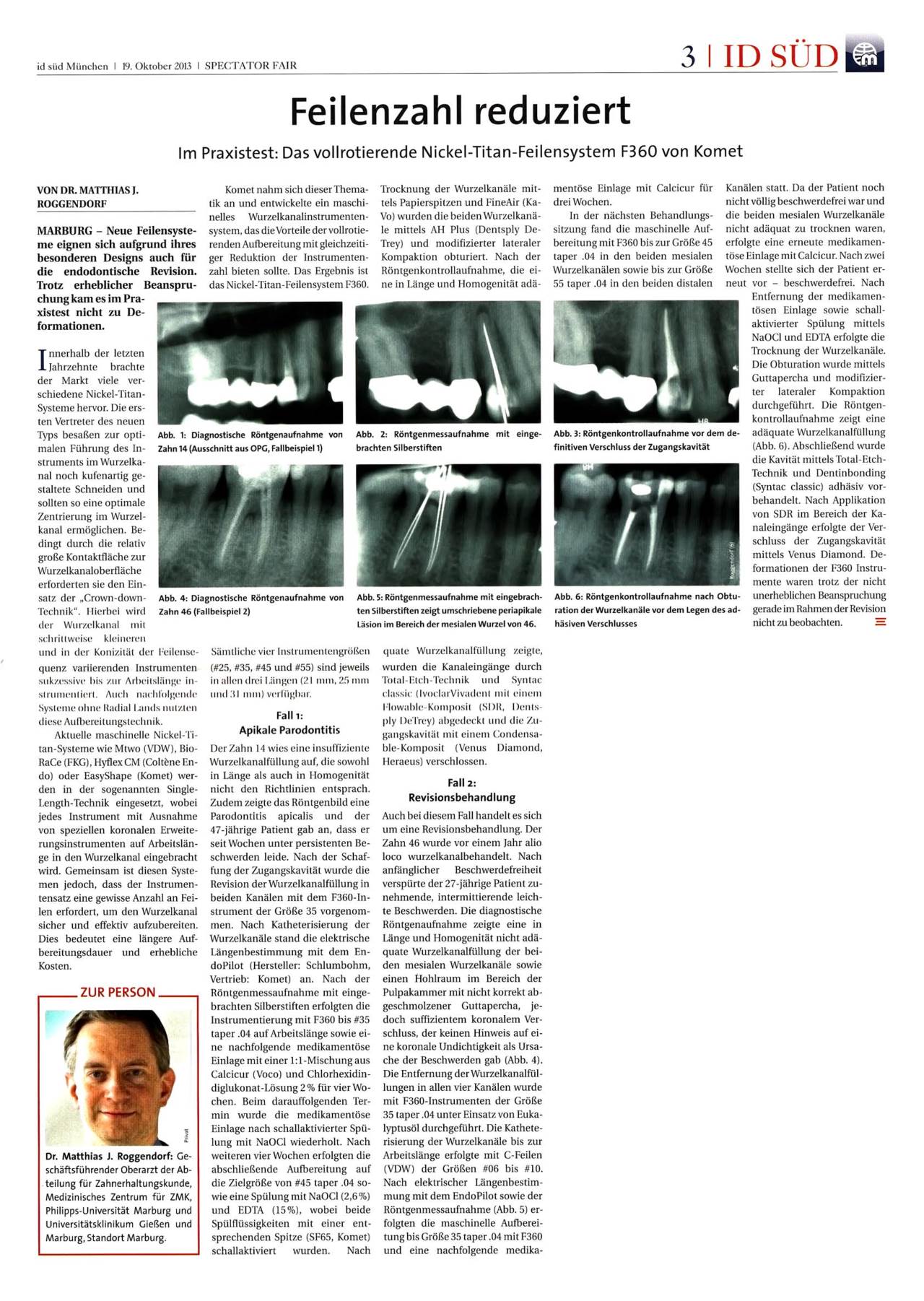 komet-f360-feilen-fachbericht-nickel-titan-praxistest image 1