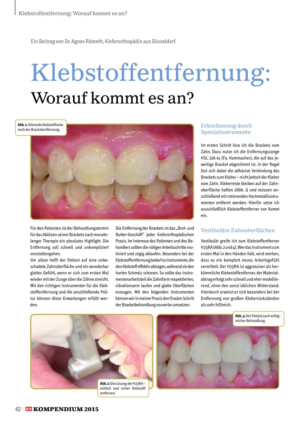 komet-diao-fachbericht-klebstoffentfernung-r-meth-12-2015 image 1