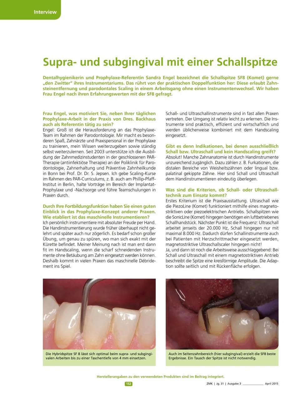 komet-sonicline-fachbericht-schallspitze-supra-subgingival image 1