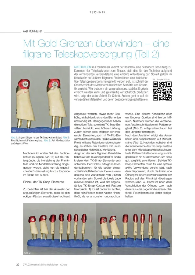 komet-dental-diao-fachbericht-teleskopversorgung-gold image 1