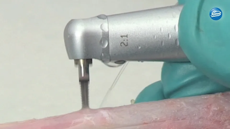 komet-dental-fq-hubfeilen-saegen-video-0-2-mm-knochenschnitt image 1