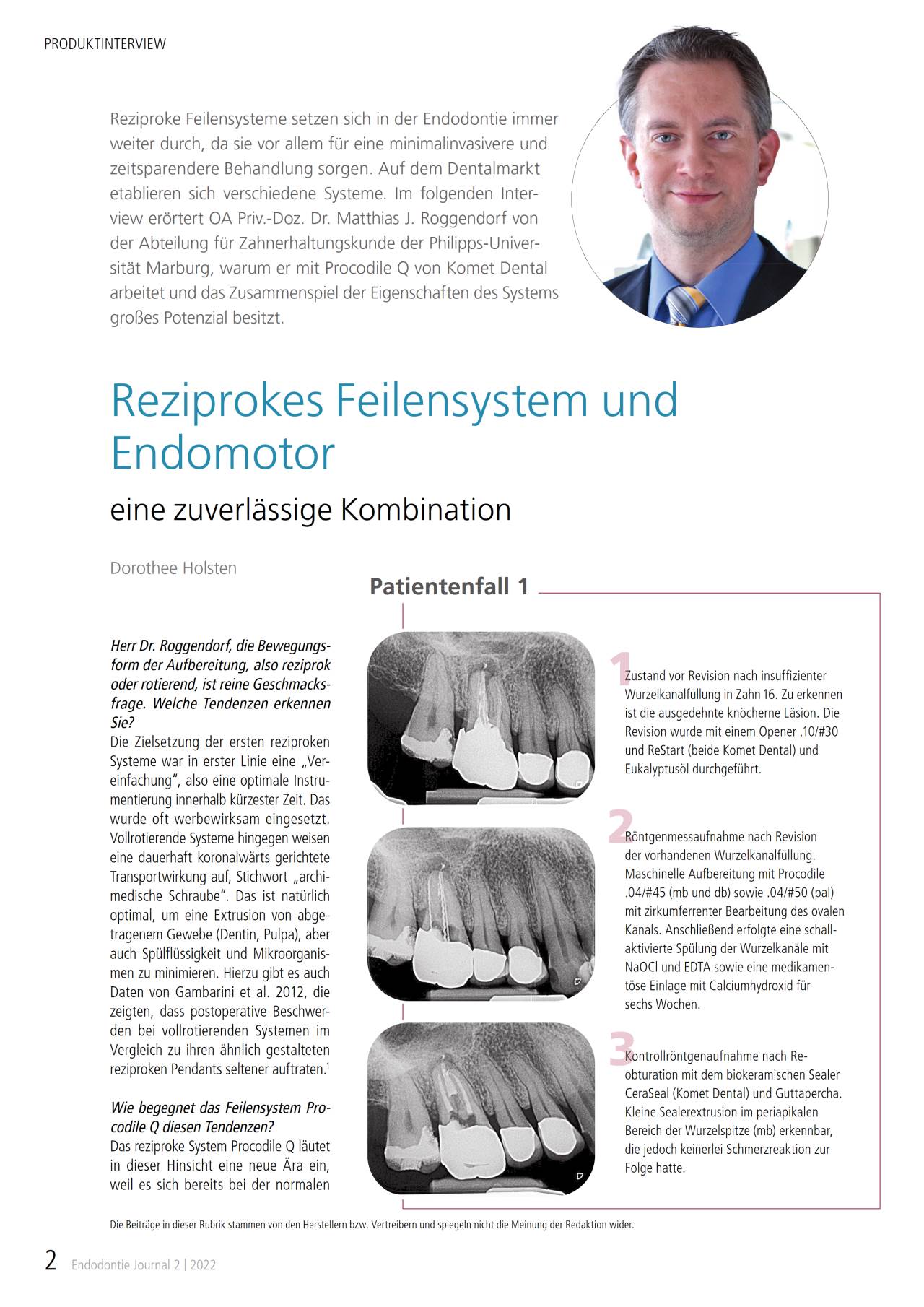 komet-dental-bioseal-sealer-fachbericht-biokeramisch image 1