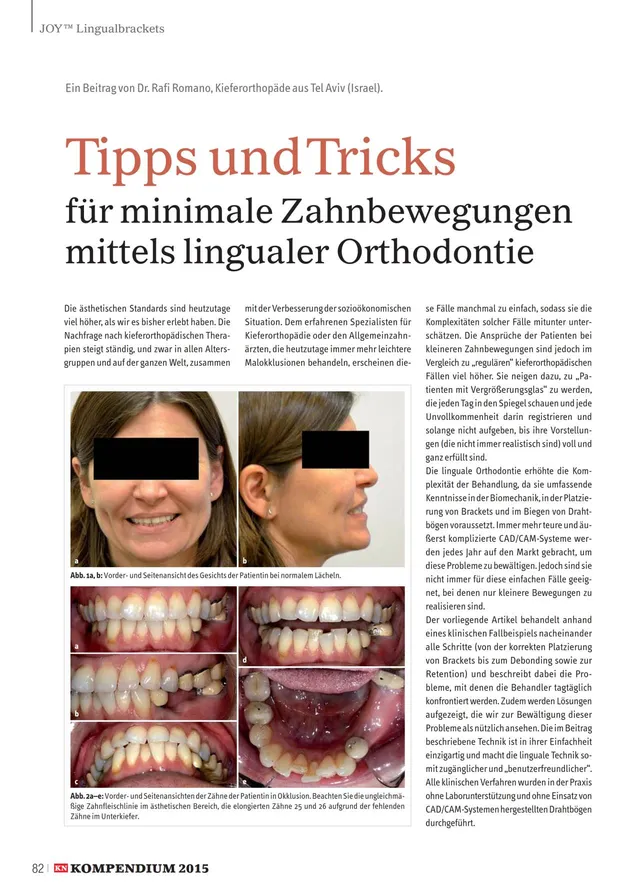 komet-sonicline-fachbericht-linguale-orthodontie-romano image 1