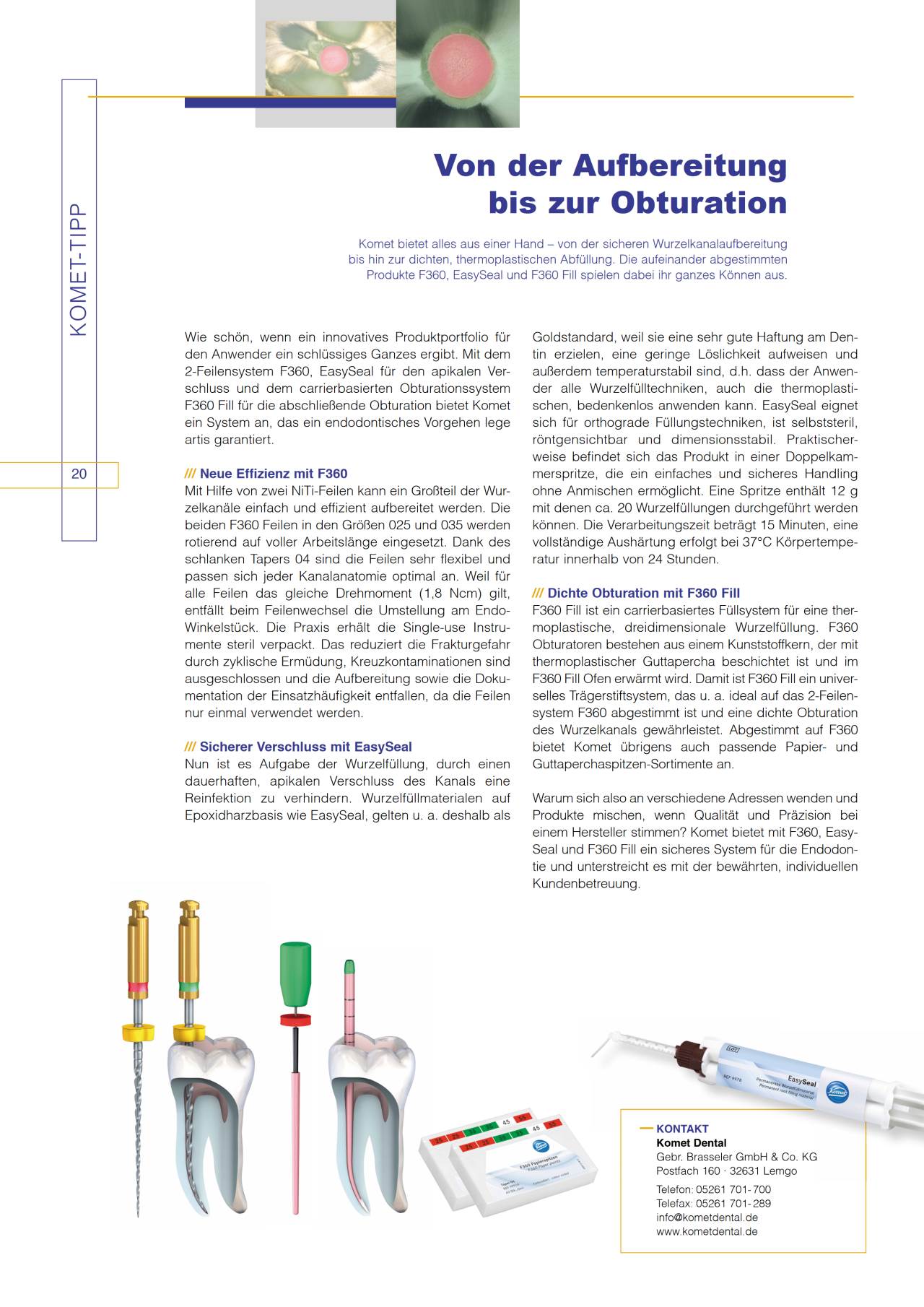 komet-dental-diao-2013-01-komet-tipp-f360-easyseal-endodontie image 1