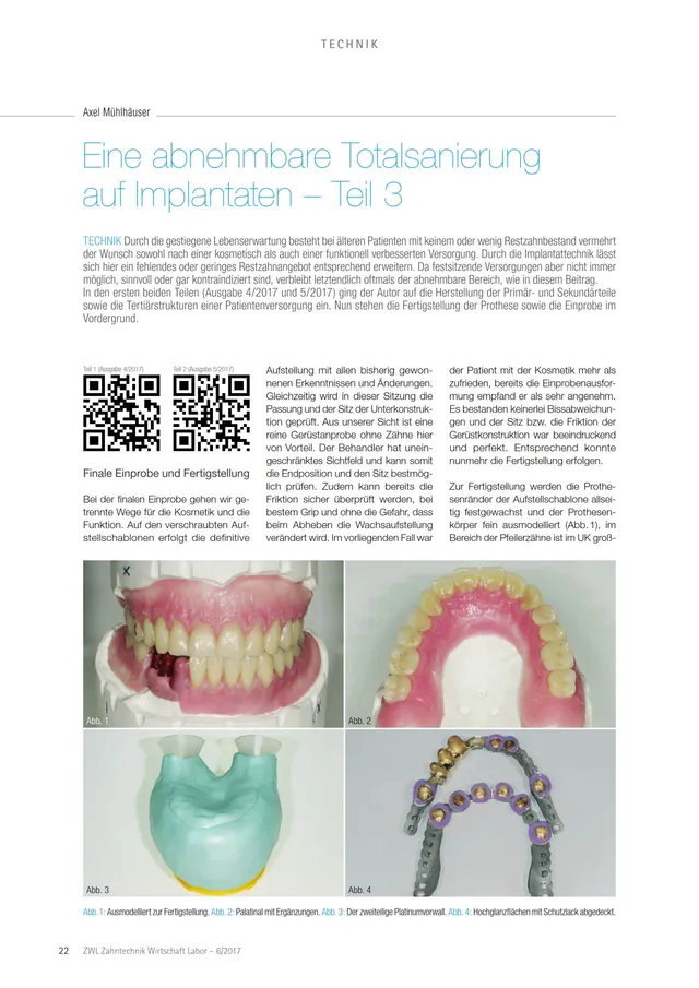 komet-ceradrill-fachbericht-totalsanierung-implantate-teil-3 image 1