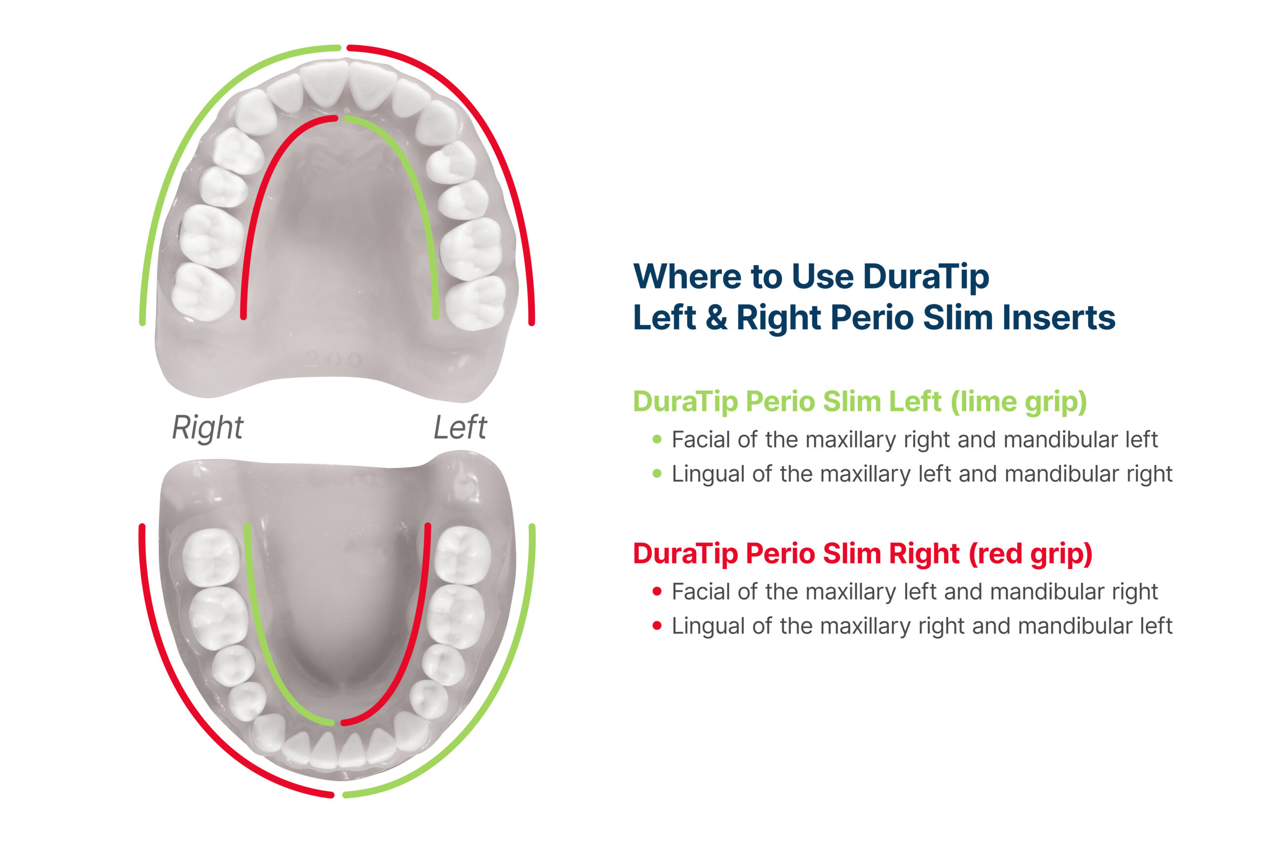 parkell-duratip-ultrasonic-eins-tze-scaler-spitzen-soft-grip image 3