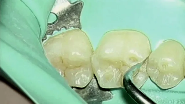 komet-sonicline-video-kavti-tenpr-paration-agabiti image 1