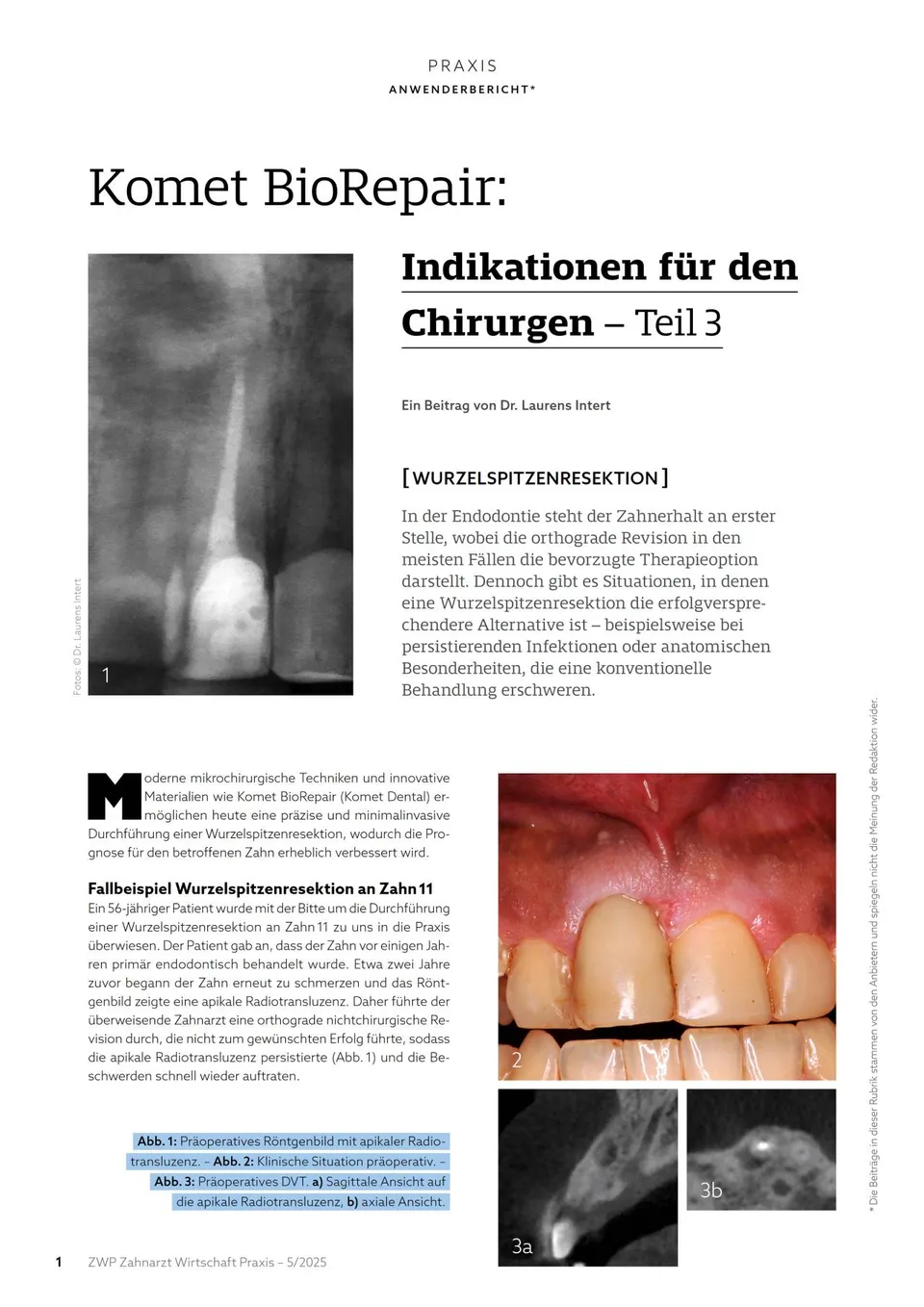 komet-dental-diao-komet-praxis-2025-05-fachbericht-biorepair-teil-3 image 1