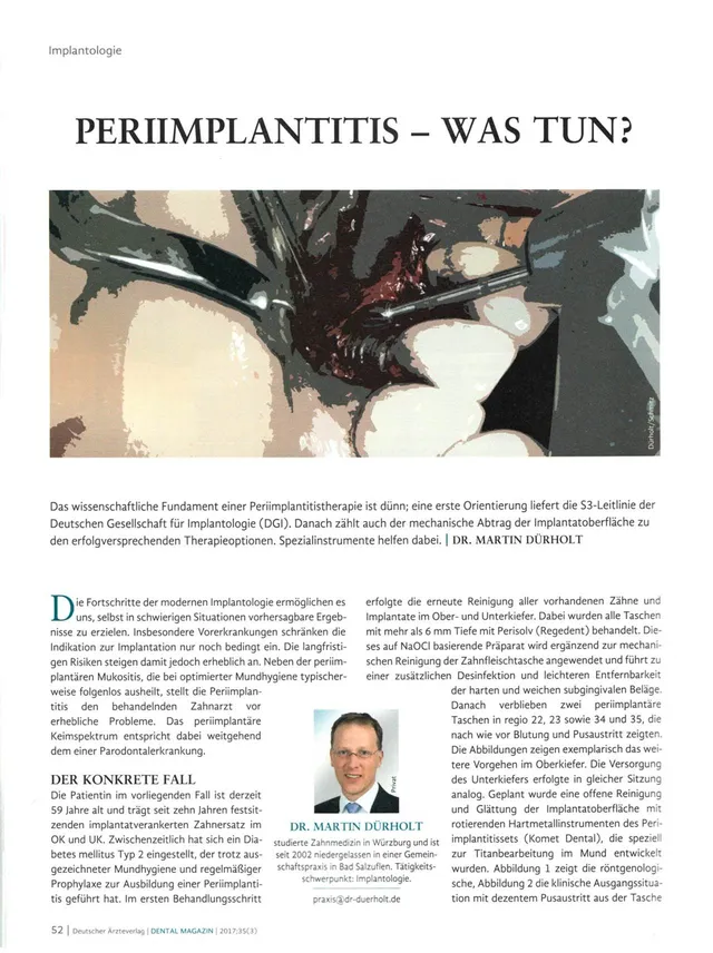 komet-dental-ceradrill-periimplantitis-fachbericht-dgi-leitlinie image 1