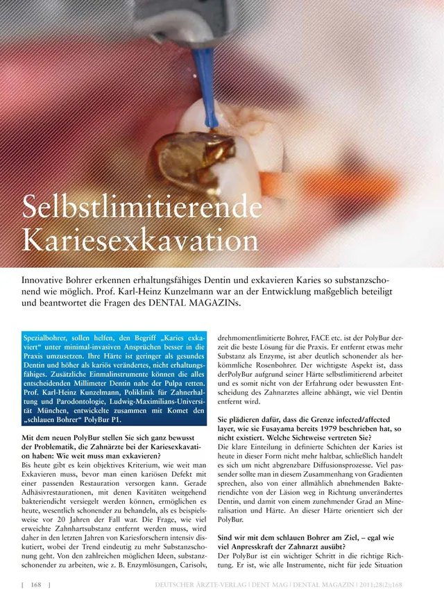 komet-diao-kariesexkavation-fachbericht-selbstlimitierend image 1