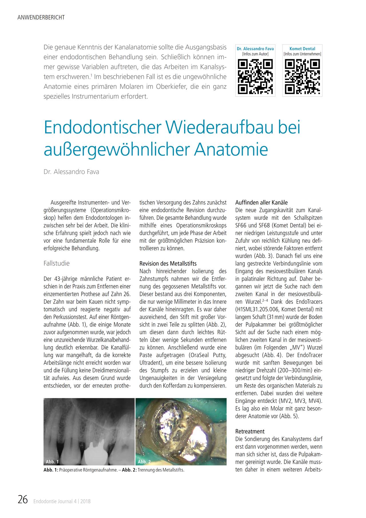 komet-fq-fachbericht-endodontischer-wiederaufbau-anatomie image 1